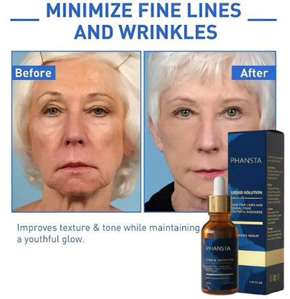 Before and after comparison of a woman's face with PHANSTA liquid solution product.